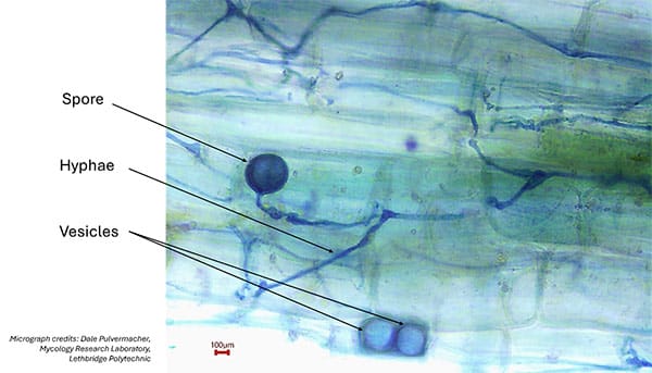 AMF structures (hyphae, vesicles and a spore) observed in the roots of Idaho fescue at 100× magnification. Micrograph : Dale Pulvermacher, Mycology Research Laboratory, Lethbridge Polytechnic.